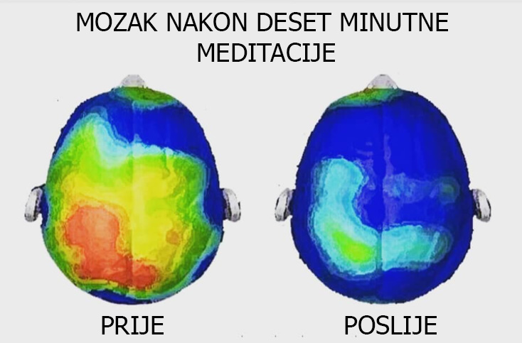 mozak i meditacija